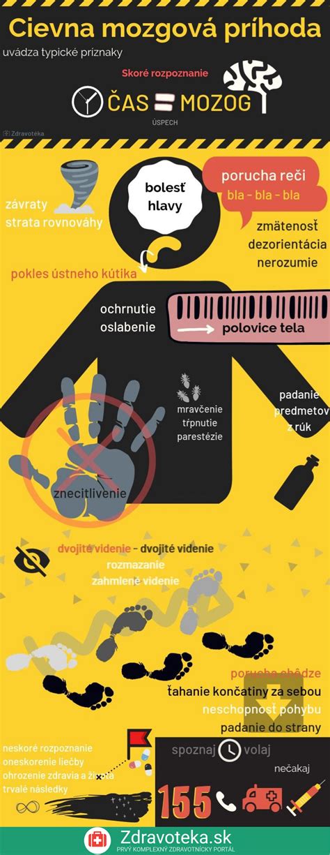 Infografika o príznakoch mozgovej príhody