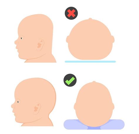 Schéma polohovania bábätka pre prevenciu zležanej hlavičky