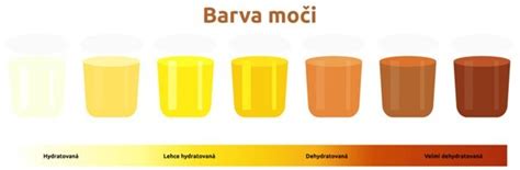 Graf farby moču a stavu hydratácie