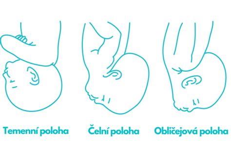 schematické znázornenie pôrodných ciest a polôh plodu
