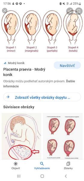 schéma pôrodných dôb