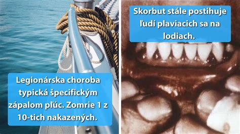 Ilustrácia zobrazujúca princíp morskej choroby