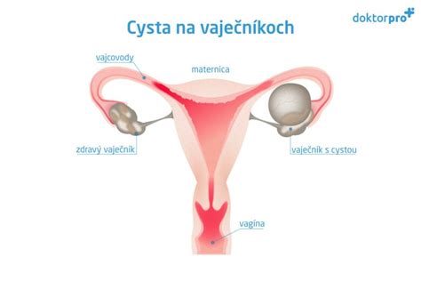 Ilustrácia ženského reprodukčného systému a menštruačného cyklu