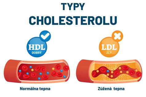 Monakolín K a jeho vplyv na tvorbu cholesterolu