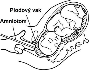 Plodová voda v maternici