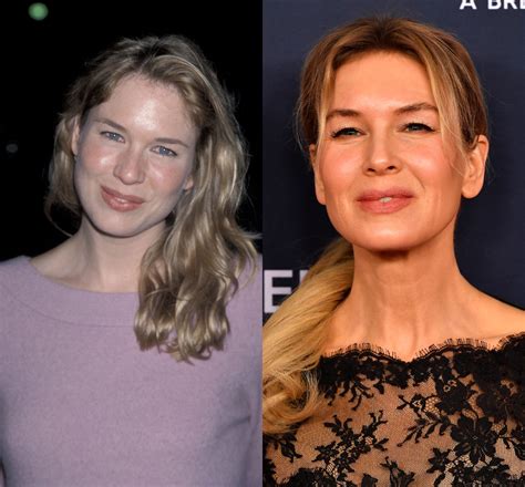 Porovnanie Renée Zellweger pred a po priberaní