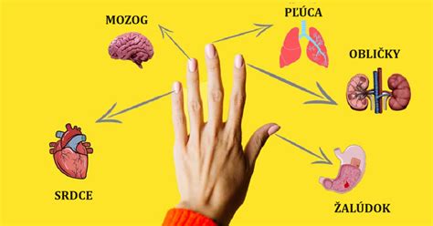 Schematické znázornenie možných zdravotných problémov bulteriéra