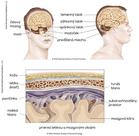 Infografika zobrazujúca cestu informácií v mozgu pri skríženej lateralite