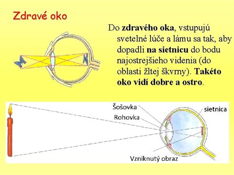 Ilustrácia zdravého oka