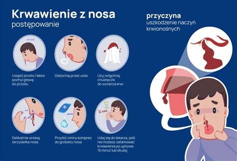 Infografika správneho postupu výplachu nosa pomocou nosovej konvičky