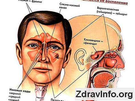 Schema znázorňujúca anatomickú štruktúru nosových dutín a nosohltana