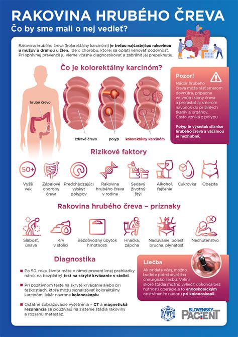 Infografika znázorňujúca povolené a zakázané potraviny pri zápale hrubého čreva