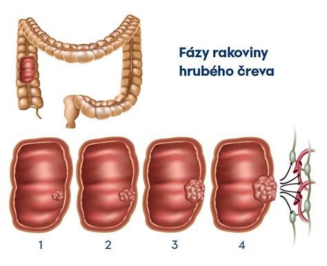 Ilustrácia zdravého čreva s probiotikami
