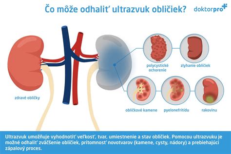 Schéma ľudských obličiek