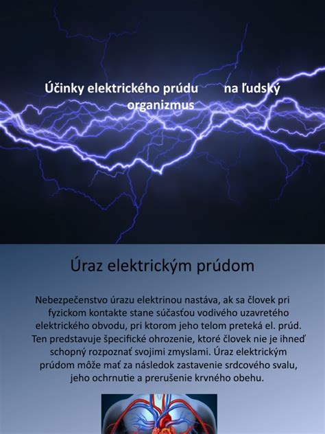 Schéma účinkov elektrického prúdu na organizmus