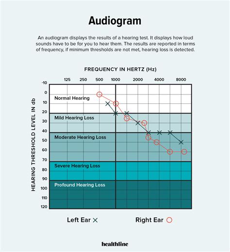Audiogram