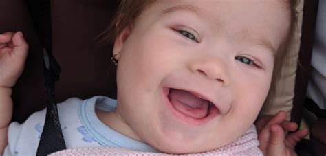 Rodina s dieťaťom s Downovým syndrómom