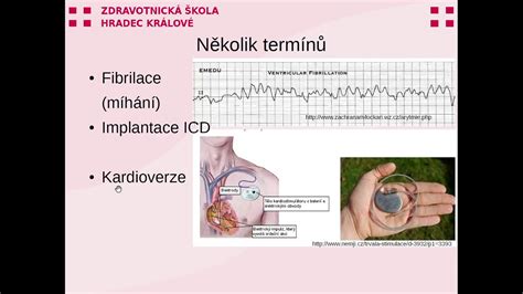graf denného rytmu bábätka