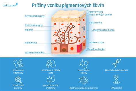 Schéma ukazujúca príčiny vzniku zaparenín u detí