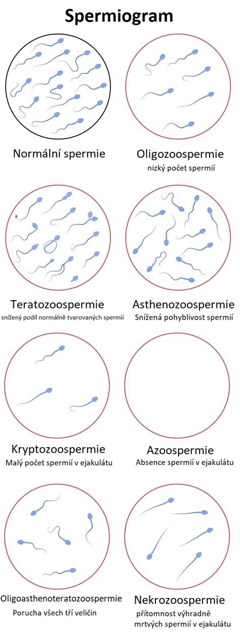 štatistika kvality spermií