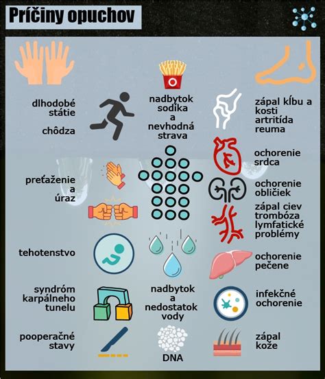 Infografika zobrazujúca príčiny opuchov nôh po pôrode