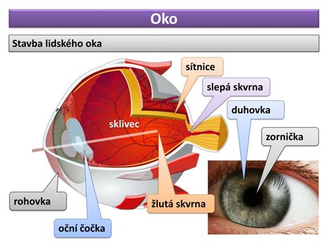 obrázok oka s papiloedémom
