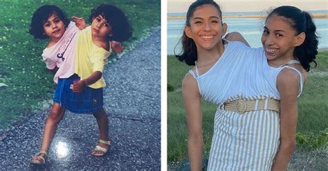 Fotografia siamských dvojičiek