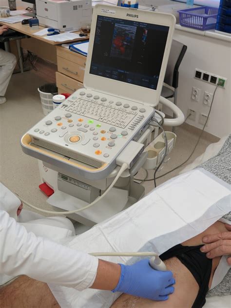 Ultrazvukové zobrazenie vaječníkov