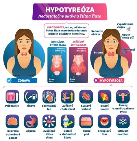 Infografika - príznaky hypertyreózy a hypotyreózy