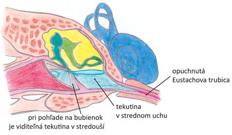Schéma vestibulárneho systému vo vnútornom uchu
