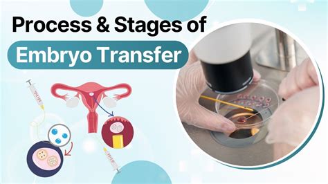 Embryotransfer do maternice