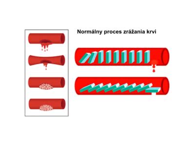 Schéma procesu zrážania krvi