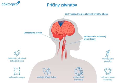 Ilustrácia znázorňujúca rôzne príčiny závratov u detí