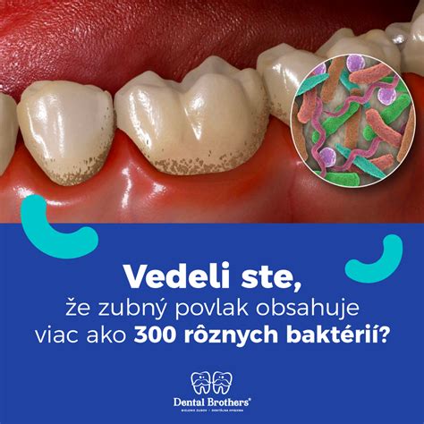 Bakteriálny povlak na zuboch