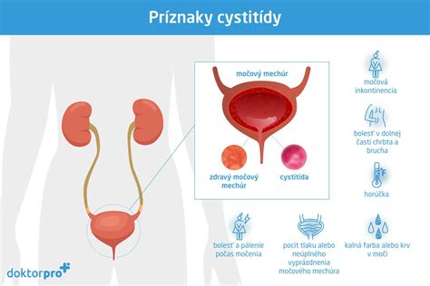 Anatomické znázornenie ženského reprodukčného systému a močového traktu