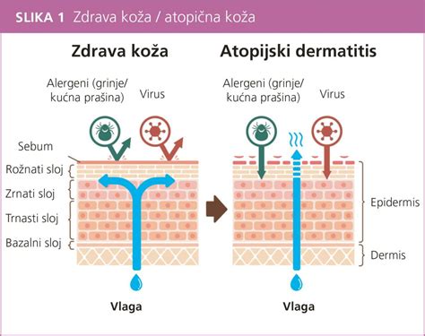 Infografika porovnávajúca benefity kontaktu koža na kožu a zavinovania