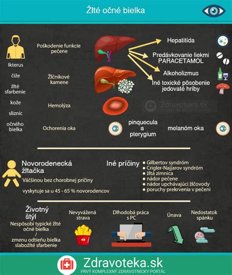 Infografika znázorňujúca percentuálne rozdelenie príčin neplodnosti párov
