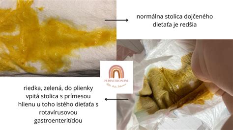 Rozdiel medzi grckaním a vracaním u dojčiat