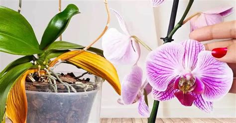 Ilustrácia starostlivosti o pupočníkový pahýľ