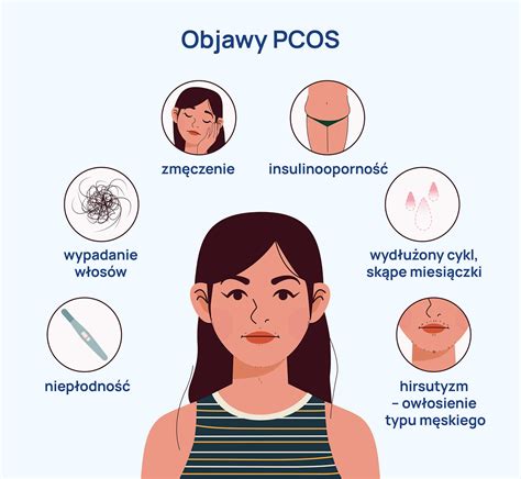 Infografika o PCOS