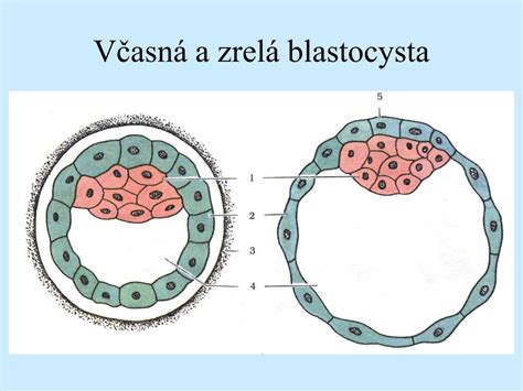 Zahniezdenie blastocysty v maternici
