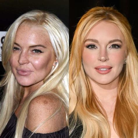 Lindsay Lohan pred a po premenách