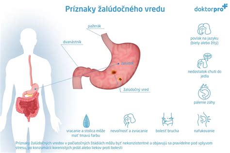 Grafické znázornenie príznakov žalúdočného vredu