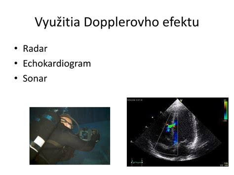 Princíp Dopplerovho efektu v ultrazvuku