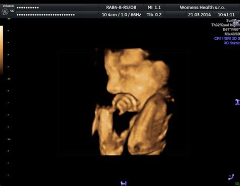 Ultrazvukové zobrazenie bábätka s palcom v ústach