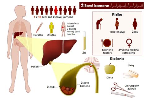 Schéma žlčníka a žlčových ciest