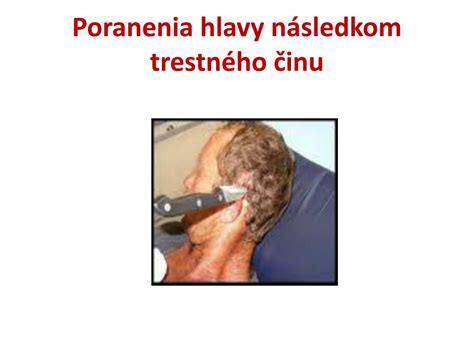 Detské poranenia hlavy